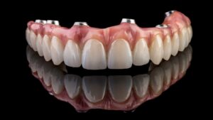 上水植牙dental implant